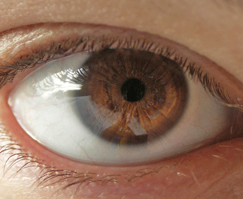眼がチカチカする原因は網膜はく離？